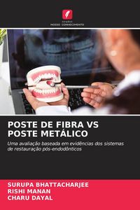 Produktbild: Poste De Fibra Vs Poste Met&aacute;lico