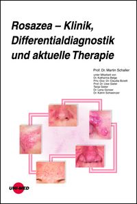 Produktbild: Rosazea &ndash; Klinik, Differentialdiagnostik und aktuelle Therapie