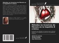Produktbild: M&eacute;todos no invasivos de fibrosis en la hepatitis B cr&oacute;nica