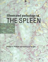 Produktbild: Illustrated Pathology of the Spleen