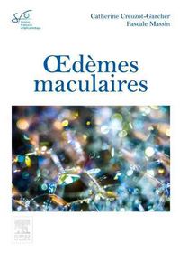 Produktbild: Oed&egrave;mes maculaires : rapport SFO 2016