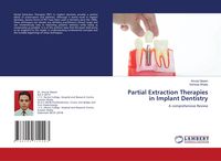 Produktbild: Partial Extraction Therapies in Implant Dentistry