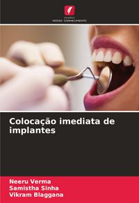 Produktbild: Coloca&ccedil;&atilde;o imediata de implantes