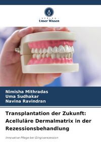 Produktbild: Transplantation der Zukunft: Acellul&auml;re Dermalmatrix in der Rezessionsbehandlung