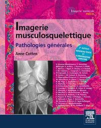 Produktbild: Cotten, A: Imagerie Musculosquelettique: Pathologies G&eacute;n&eacute;ral