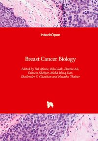 Produktbild: Breast Cancer Biology
