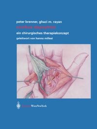 Produktbild: Morbus Dupuytren