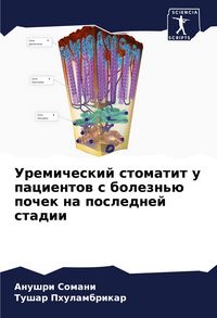 Produktbild: Uremicheskij stomatit u pacientow s bolezn'&uuml; pochek na poslednej stadii