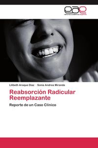 Produktbild: Reabsorci&oacute;n Radicular Reemplazante