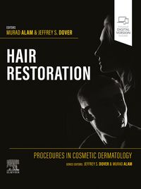 Produktbild: Procedures in Cosmetic Dermatology: Hair Restoration - E-Book