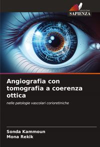 Produktbild: Angiografia con tomografia a coerenza ottica