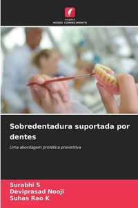 Produktbild: Sobredentadura suportada por dentes