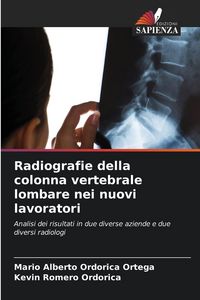 Produktbild: Radiografie della colonna vertebrale lombare nei nuovi lavoratori