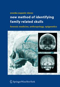 Produktbild: New Method of Identifying Family Related Skulls