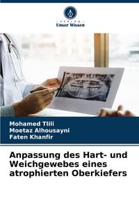 Produktbild: Anpassung des Hart- und Weichgewebes eines atrophierten Oberkiefers