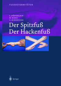 Produktbild: Fussdeformit&auml;ten