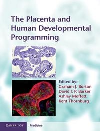 Produktbild: Placenta and Human Developmental Programming
