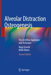 Produktbild: Alveolar Distraction Osteogenesis
