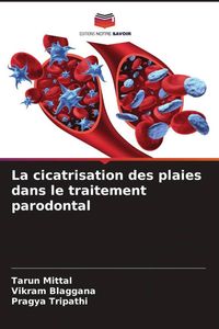 Produktbild: La cicatrisation des plaies dans le traitement parodontal