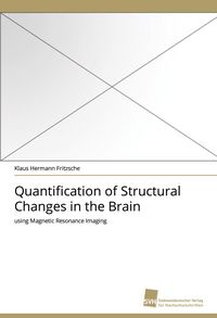 Produktbild: Quantification of Structural Changes in the Brain