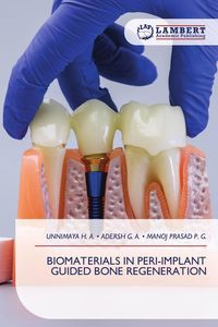 Produktbild: BIOMATERIALS IN PERI-IMPLANT GUIDED BONE REGENERATION
