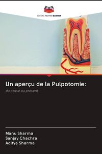 Produktbild: Un aper&ccedil;u de la Pulpotomie: