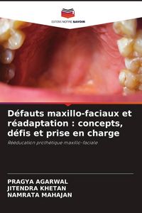 Produktbild: D&eacute;fauts maxillo-faciaux et r&eacute;adaptation : concepts, d&eacute;fis et prise en charge