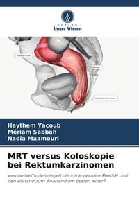 Produktbild: MRT versus Koloskopie bei Rektumkarzinomen