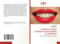 Produktbild: Facettes en r&eacute;sine composite versus Facettes en c&eacute;ramique