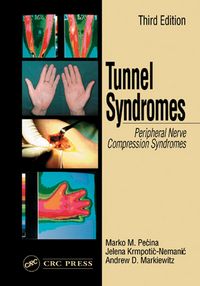 Produktbild: Tunnel Syndromes
