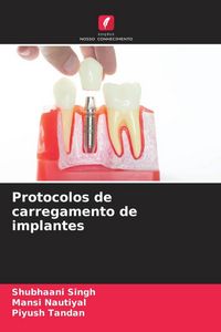 Produktbild: Protocolos de carregamento de implantes
