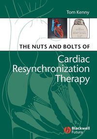 Produktbild: The Nuts and Bolts of Cardiac Resynchronization Therapy