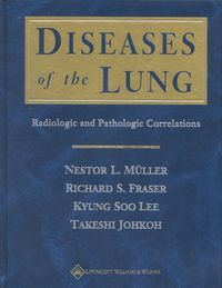 Produktbild: Diseases of the Lung: Radiologic and Pathologic Correlations