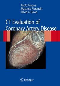 Produktbild: Ct Evaluation Of Coronary Arte