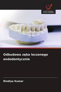 Produktbild: Odbudowa z&iquest;ba leczonego endodontycznie