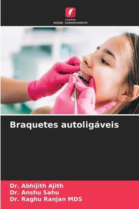 Produktbild: Braquetes autolig&aacute;veis