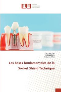 Produktbild: Les bases fondamentales de la Socket Shield Technique