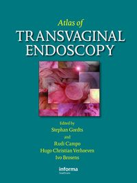 Bild vom Artikel Atlas of Transvaginal Endoscopy vom Autor 