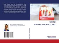 Produktbild: Implant Surgical Guides