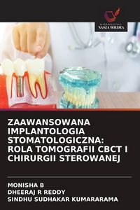 Produktbild: ZAAWANSOWANA IMPLANTOLOGIA STOMATOLOGICZNA: ROLA TOMOGRAFII CBCT I CHIRURGII STEROWANEJ