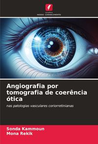 Produktbild: Angiografia por tomografia de coer&ecirc;ncia &oacute;tica