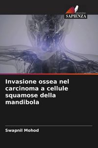 Produktbild: Invasione ossea nel carcinoma a cellule squamose della mandibola