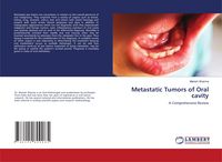 Produktbild: Metastatic Tumors of Oral cavity