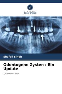 Produktbild: Odontogene Zysten : Ein Update