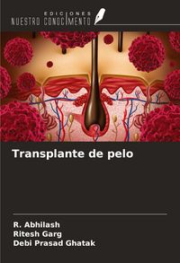 Produktbild: Transplante de pelo