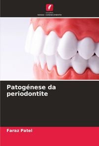 Produktbild: Patog&eacute;nese da periodontite