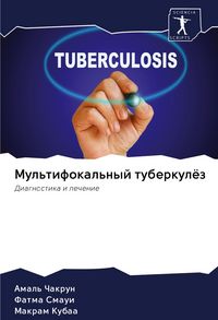 Produktbild: Mul'tifokal'nyj tuberkul&ouml;z
