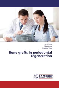 Produktbild: Bone grafts in periodontal regeneration