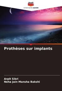 Produktbild: Proth&egrave;ses sur implants