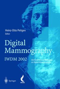 Produktbild: Digital Mammography